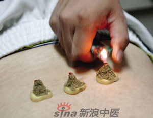 灸法的種類  你知道多少？